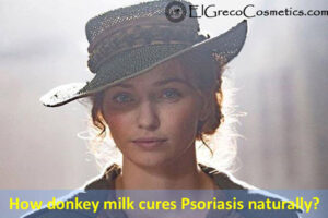 How donkey milk cures Psoriasis naturally