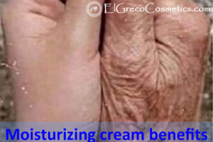Moisturizing cream benefits